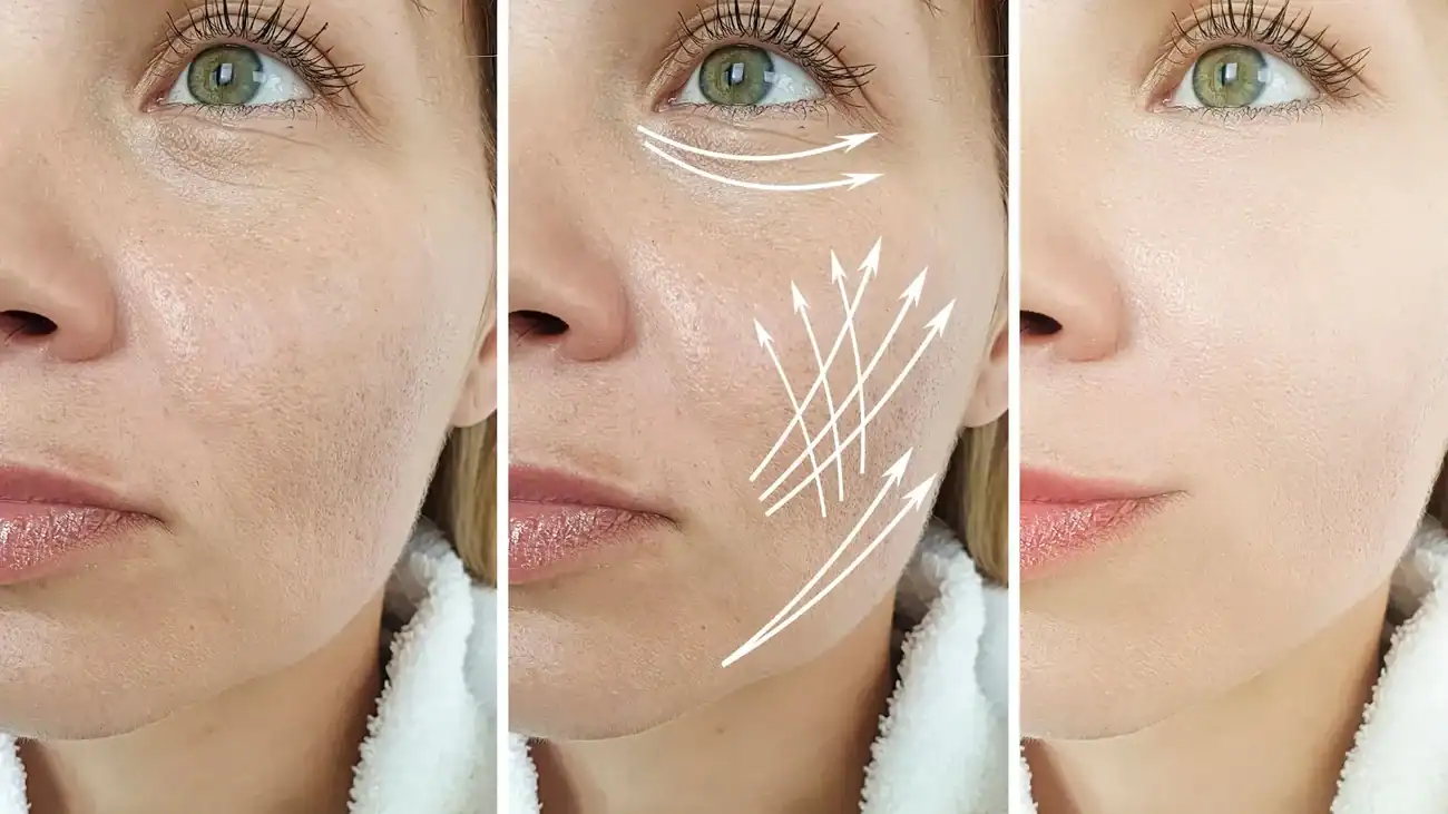 Can One Treatment Really Tackle More Than One Skin Concern Eynsham?