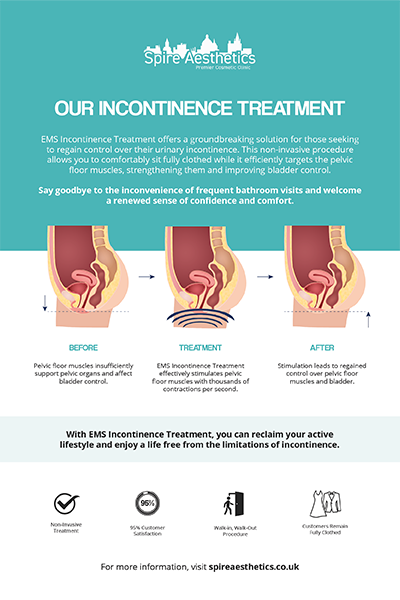 image to show how EMS treatment works for female urinary incontinence Eynsham