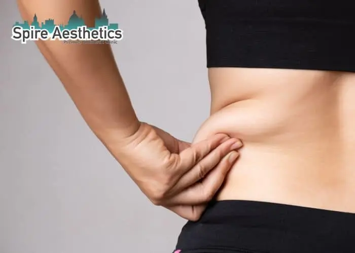 Image of woman pinching fat on their hips Eynsham. Fat Freezing treatment 