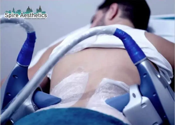 Man having fat freezing treatment done on love handles before a competitions Eynsham to create a sculpted look.