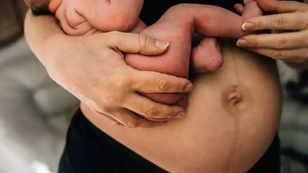 Why Is My Stomach Still Big After Pregnancy Eynsham?